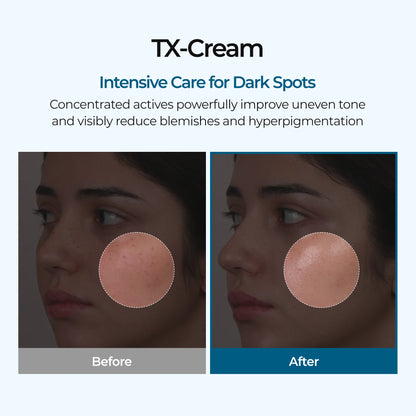 TX Cream | Tranexamic Acid & Niacinamide Dark Spot & Hyperpigmentation Care
