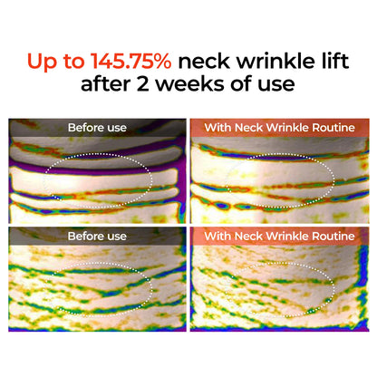 3-Minute Neck & Face Anti-Aging Ritual Set