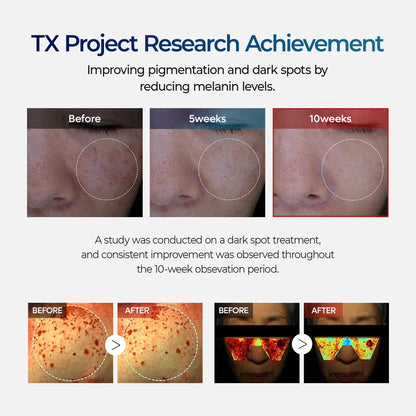 TX Cream | Tranexamic Acid & Niacinamide Dark Spot & Hyperpigmentation Care
